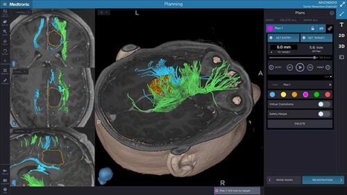 Medtronic Synergy Cranial Software and Stealth Station S7 Cranial Software